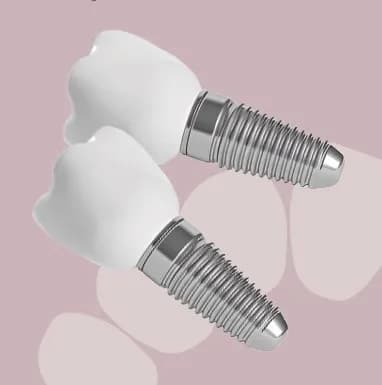 При имплантации зубов - ирригатор в подарок!